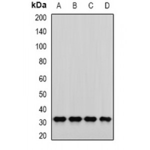 LifeSab™ PNP Rabbit pAb (50 µl)