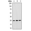 LifeSab™ TFIIF RAP 30 Rabbit pAb (50 µl)