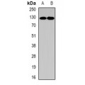 LifeSab™ PUM1 Rabbit pAb (50 µl)