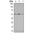 LifeSab™ IRAK4 Rabbit pAb (50 µl)