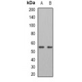 LifeSab™ ATGL Rabbit pAb (50 µl)