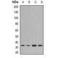 LifeSab™ HSD17B13 Rabbit pAb (50 µl)