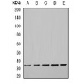 LifeSab™ CFDP1 Rabbit pAb (50 µl)