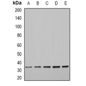 LifeSab™ CFDP1 Rabbit pAb (50 µl)