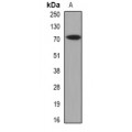 LifeSab™ CAT1 Rabbit pAb (50 µl)