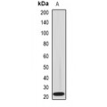LifeSab™ IL-18BP Rabbit pAb (50 µl)
