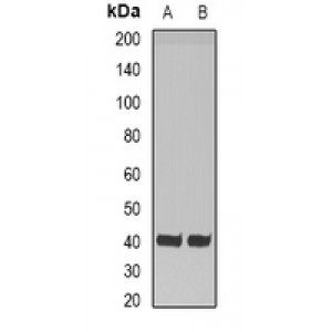 LifeSab™ HAO1 Rabbit pAb (50 µl)
