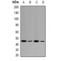 LifeSab™ FAH Rabbit pAb (50 µl)