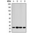 LifeSab™ HAGH Rabbit pAb (50 µl)