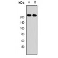 LifeSab™ KIF1B Rabbit pAb (50 µl)