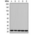 LifeSab™ PCMT1 Rabbit pAb (50 µl)
