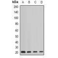 LifeSab™ AGR2 Rabbit pAb (50 µl)