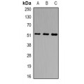 LifeSab™ NSUN6 Rabbit pAb (50 µl)