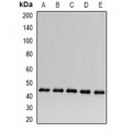 LifeSab™ ACADS Rabbit pAb (50 µl)