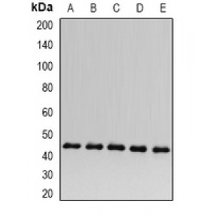 LifeSab™ ACADS Rabbit pAb (50 µl)