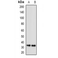 LifeSab™ SGTA Rabbit pAb (50 µl)