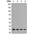 LifeSab™ PSMB8 Rabbit pAb (50 µl)