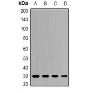 LifeSab™ PSMB8 Rabbit pAb (50 µl)