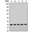 LifeSab™ LHX6 Rabbit pAb (50 µl)
