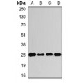 LifeSab™ VENTX Rabbit pAb (50 µl)