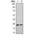 LifeSab™ DNAJB9 Rabbit pAb (50 µl)