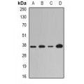 LifeSab™ LOX Rabbit pAb (50 µl)