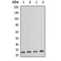LifeSab™ NAT8 Rabbit pAb (50 µl)