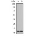 LifeSab™ CPLX2 Rabbit pAb (50 µl)
