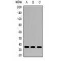 LifeSab™ AKR1B10 Rabbit pAb (50 µl)