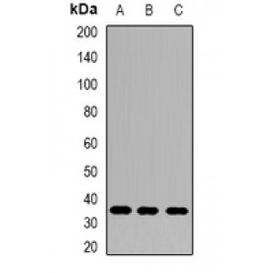 LifeSab™ AKR1B10 Rabbit pAb (50 µl)