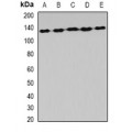 LifeSab™ AARS1 Rabbit pAb (50 µl)
