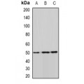LifeSab™ ALDH9A1 Rabbit pAb (50 µl)