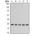 LifeSab™ SPR Rabbit pAb (50 µl)