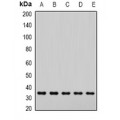 LifeSab™ NAPA Rabbit pAb (50 µl)