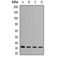 LifeSab™ HMGCL Rabbit pAb (50 µl)