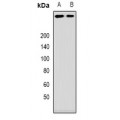 LifeSab™ ANKHD1 Rabbit pAb (50 µl)