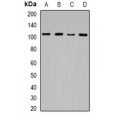 LifeSab™ JHDM1D Rabbit pAb (50 µl)