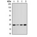 LifeSab™ APC10 Rabbit pAb (50 µl)