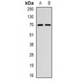 LifeSab™ EME1 Rabbit pAb (50 µl)