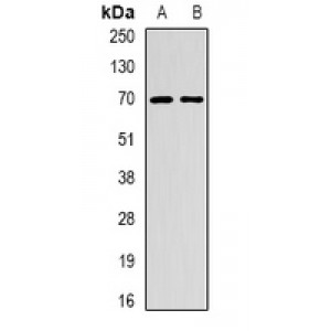 LifeSab™ EME1 Rabbit pAb (50 µl)