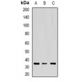 LifeSab™ CD272 Rabbit pAb (50 µl)