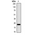 LifeSab™ Rac 1 (pS71) Rabbit pAb (50 µl)