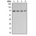 LifeSab™ ACAD9 Rabbit pAb (50 µl)