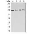 LifeSab™ ACADVL Rabbit pAb (50 µl)