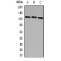 LifeSab™ ADAMTS5 Rabbit pAb (50 µl)
