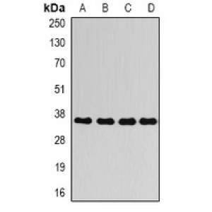 LifeSab™ AKR1C4 Rabbit pAb (50 µl)