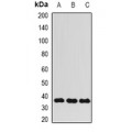 LifeSab™ ALKBH3 Rabbit pAb (50 µl)