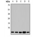 LifeSab™ B2M Rabbit pAb (50 µl)