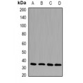 LifeSab™ CD33 Rabbit pAb (50 µl)