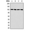LifeSab™ CLCN5 Rabbit pAb (50 µl)